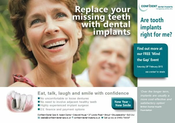 Mẫu tờ trơi quảng cáo trồng răng được thiết kế chi tiết cùng một vài tư vấn giúp khách hàng yên tâm khí đến với phòng khám