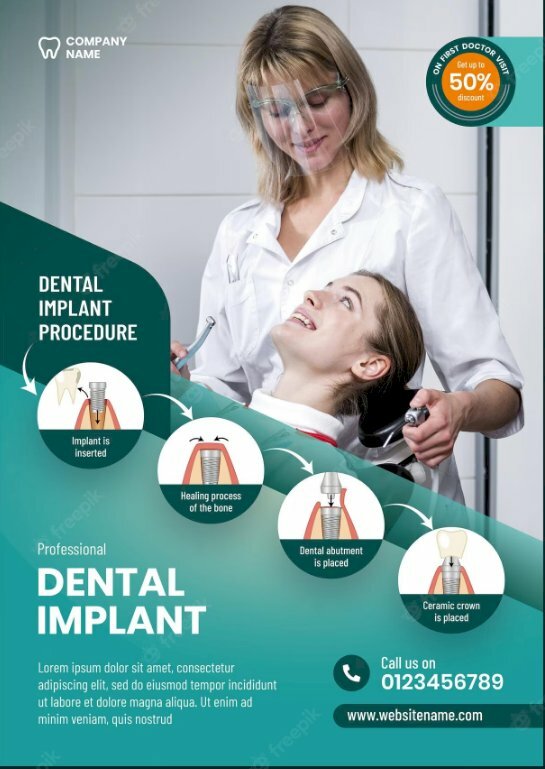 Mẫu thiết kế tờ rơi quảng cáo trồng răng Implant đẹp mắt
